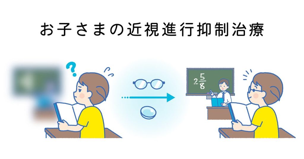 お子さまの近視進行抑制治療