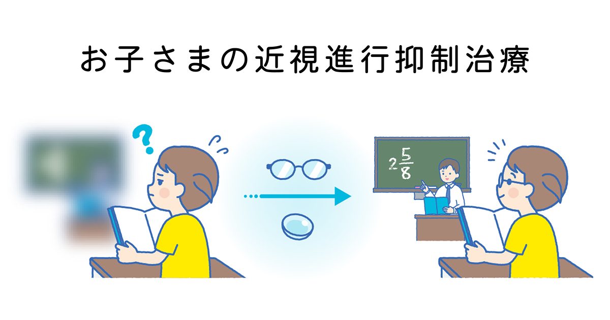 お子さまの近視進行抑制治療